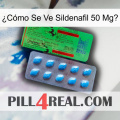 ¿Cómo Se Ve Sildenafil 50 Mgo new03